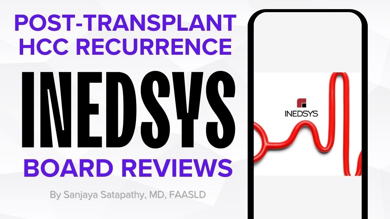 Post-Transplant HCC Recurrence by Prof. Sanjaya Satapathy, MD, FAASLD