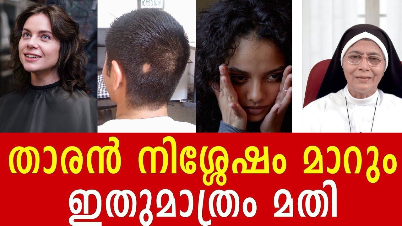 താരൻ നിശ്ശേഷം മാറും ഇതുമാത്രം മതി.