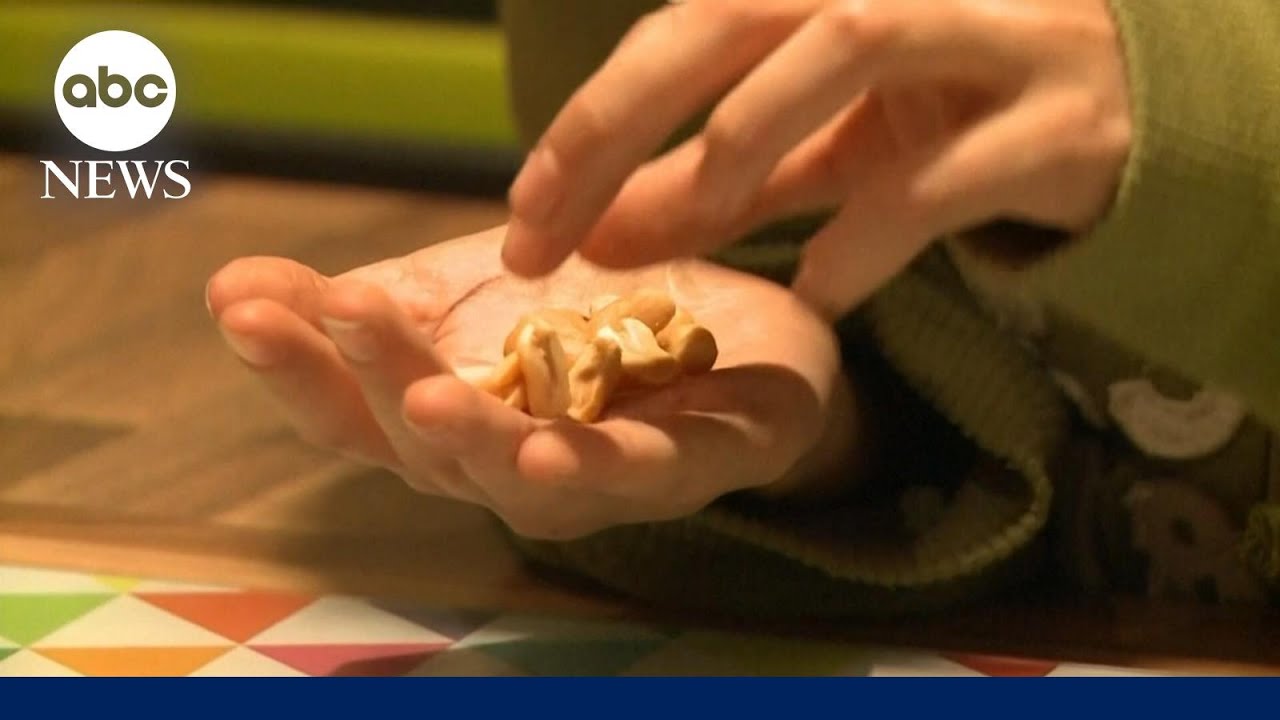 Experimental patch shows promise for kids with peanut allergies l GMA
