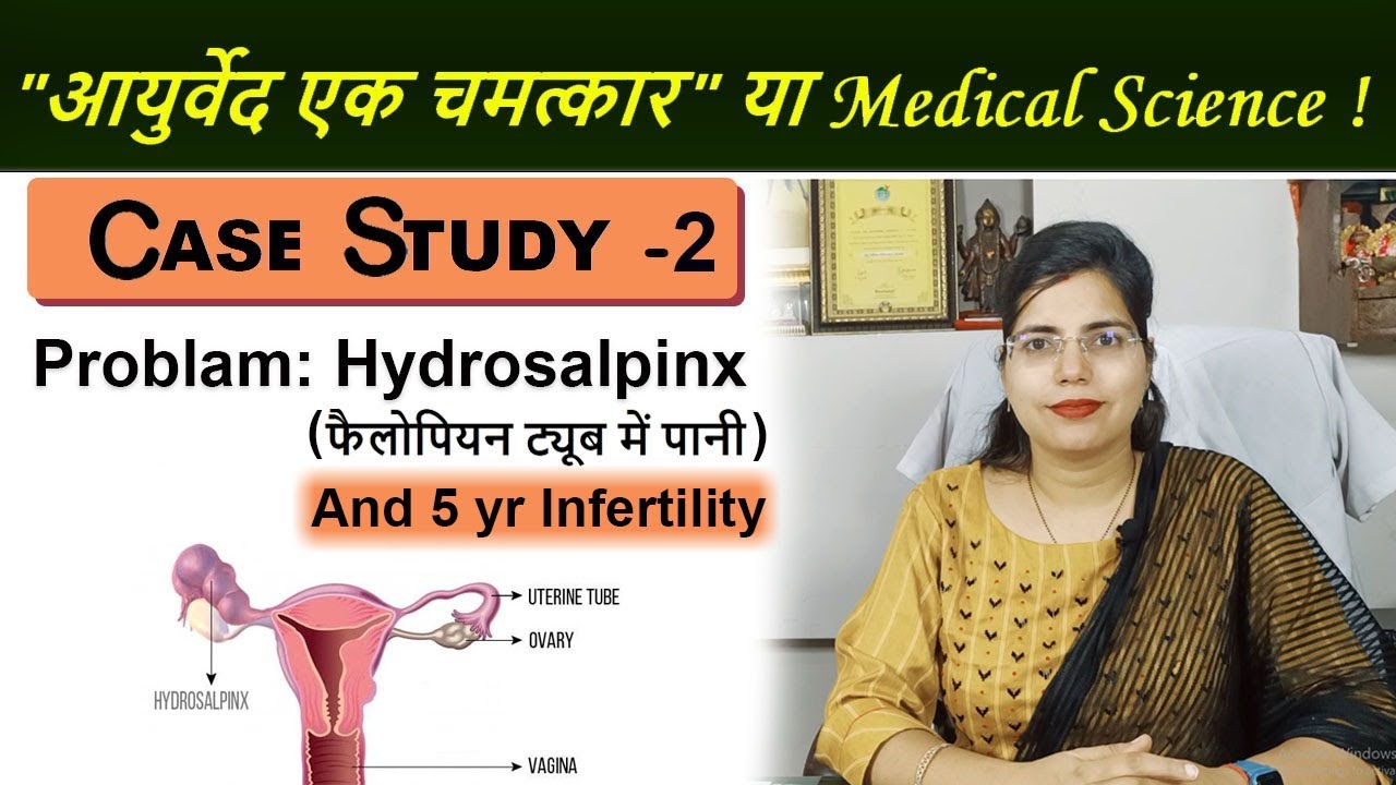 Case Study 2: Successful Hydrosalpinx (Fluid in Fallopian Tubes) Treatment | Dr Chanchal Sharma