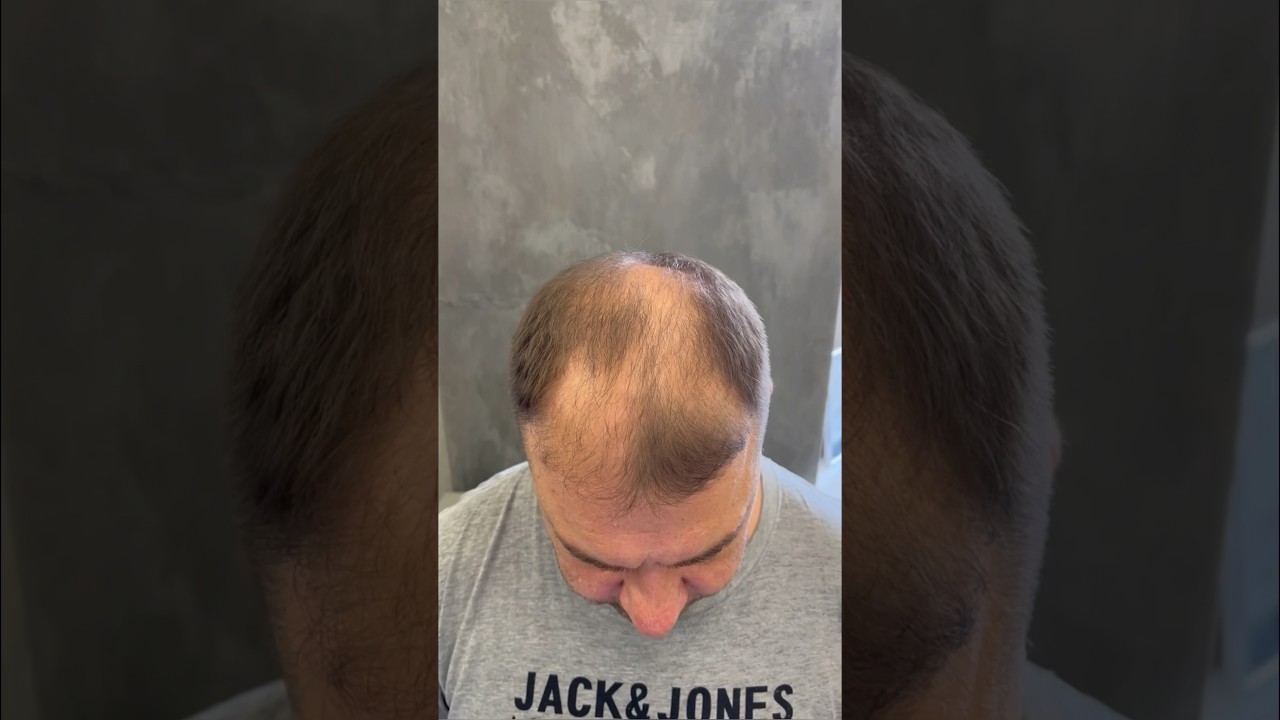 How I Concealed Damage Thin Hair with a Hair Powder🧡 #hairstyle