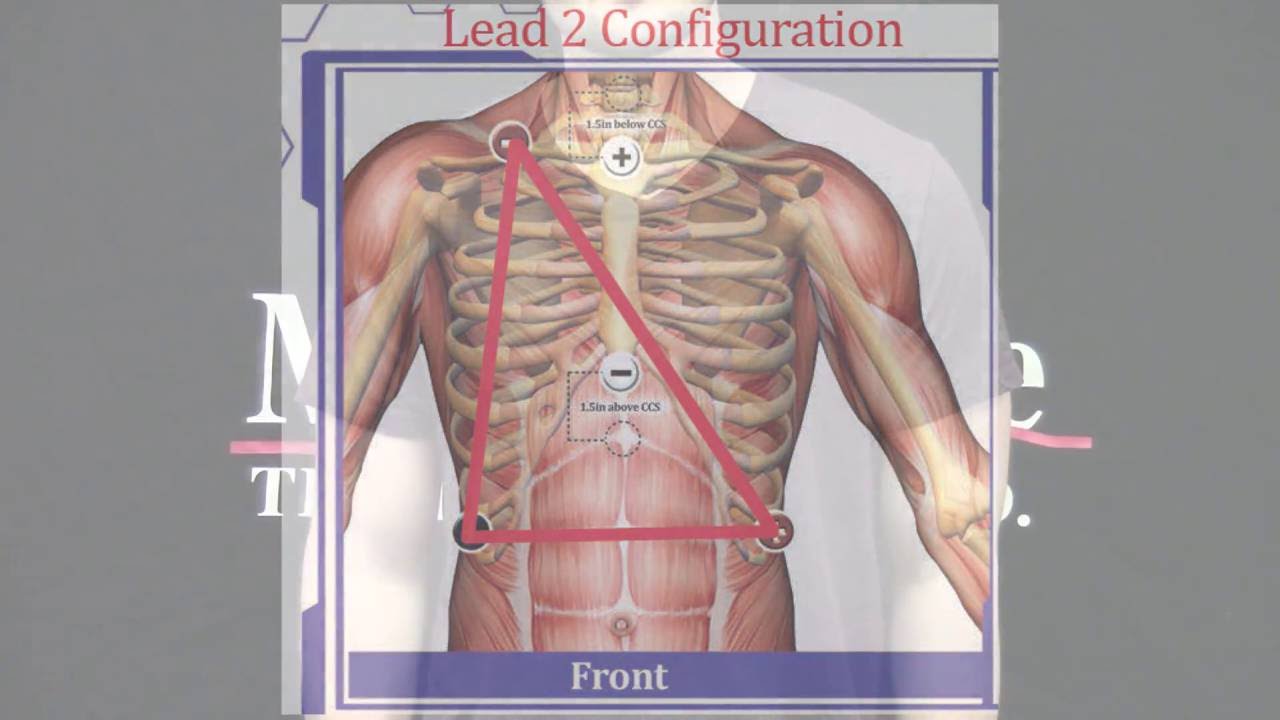 Electrode Placement Training for Electrocardiogram (ECG)