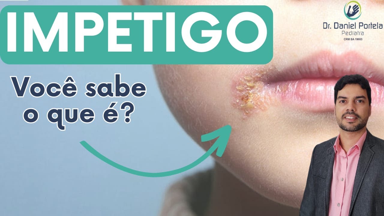 Feridas espalhadas na pele da criança (impetigo)