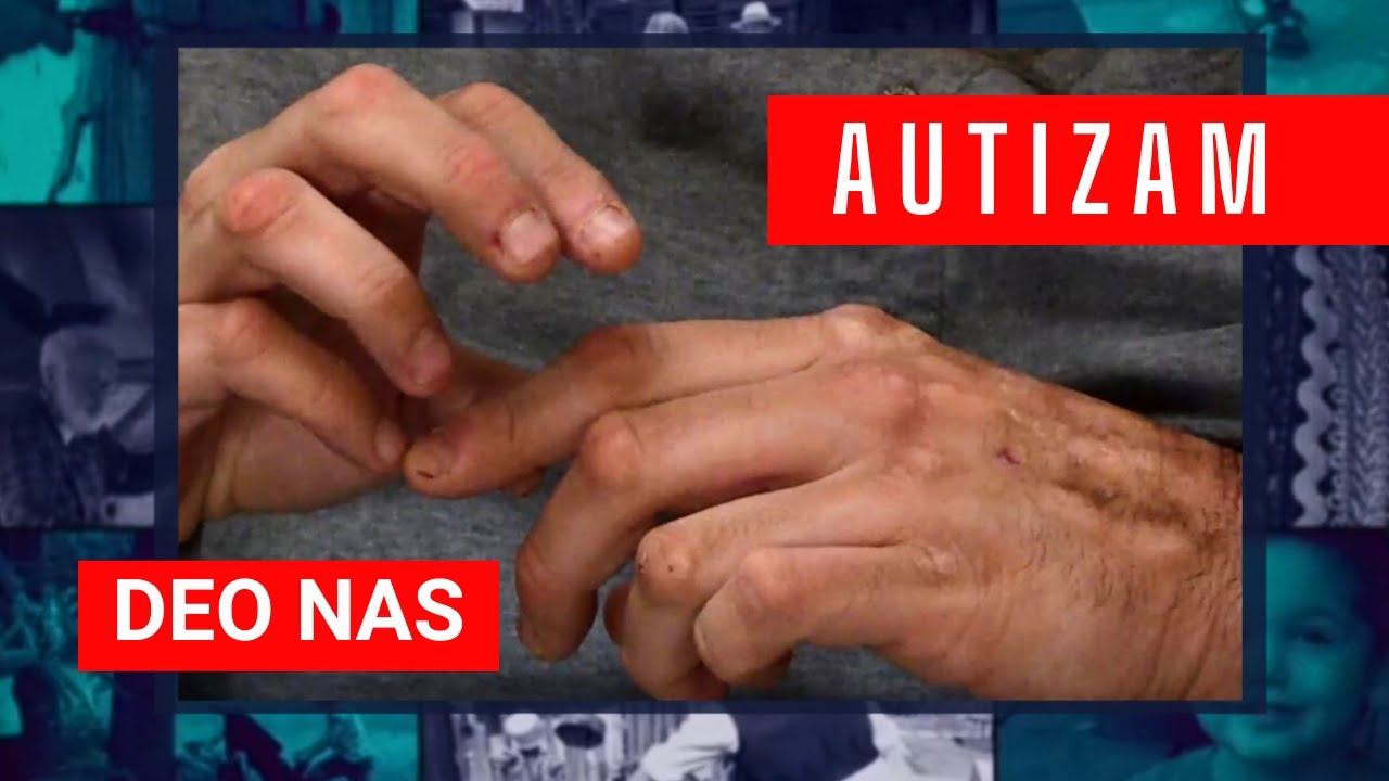 DEO NAS - Autizam je mnogima samo reč, ali za Veljka (43) i Luku (12) ceo život