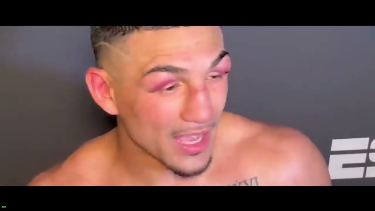 Teofimo Lopez Announces RETIREMENT After Shakur Stevenson LOSS.. (Post Fight Interview)