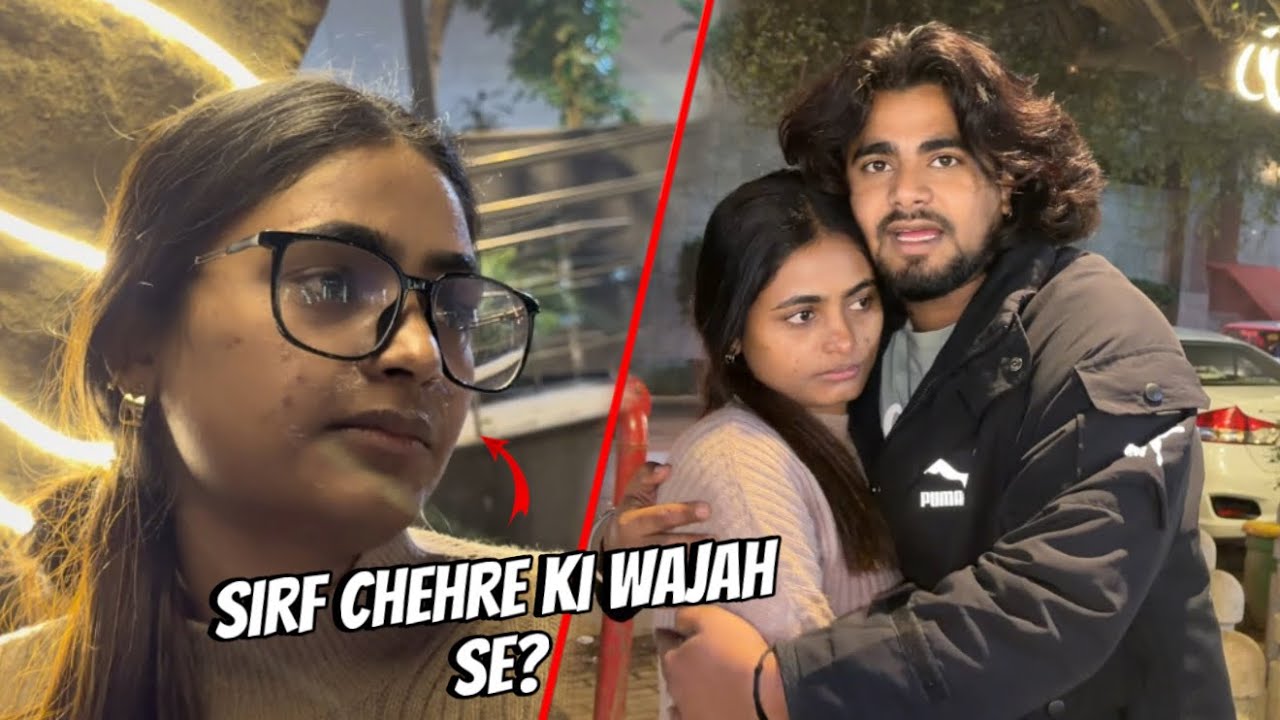 Ansh Mujhe Isliye Chhod Raha Hai Kyunki Mera Face Kharab Ho Gaya 😭