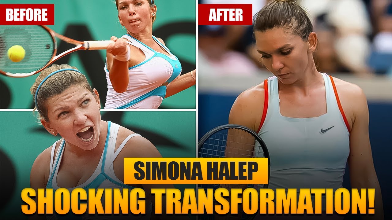 Simona Halep Before and After Breast Reduction: How Her Transformation Led to Her Wimbledon Win!