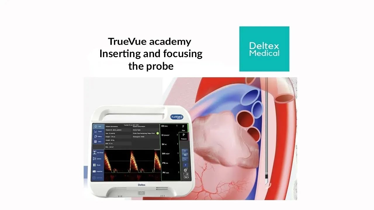 Deltex Academy - Inserting and focusing the probe