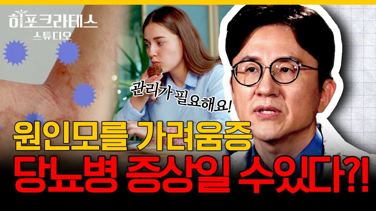 사람 미치게 만드는 가려움증! 알고 보니 무시무시한 질환들의 신호? 면역 관리하고 가려움증 예방하는 법  [서재걸의 면역내과]