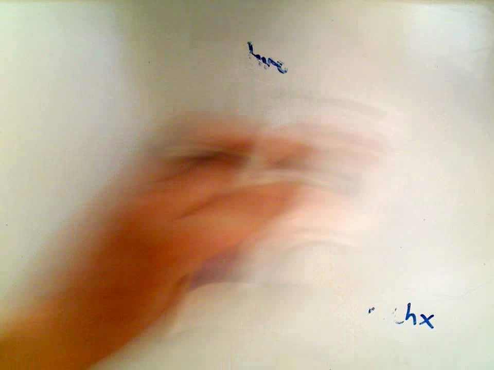 Hyperbolic Functions - Derivatives