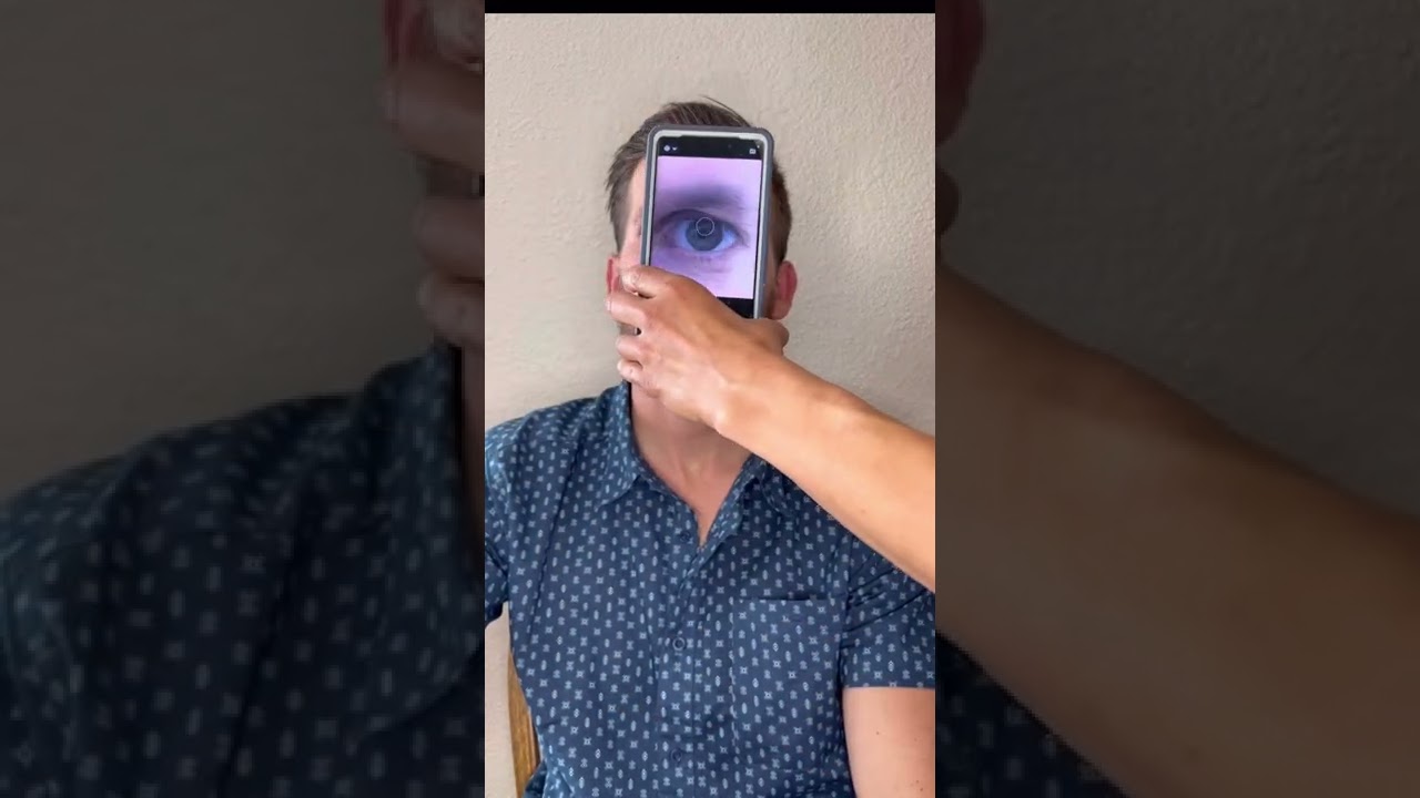 How to take a photo of your eye for an Iridology Reading.