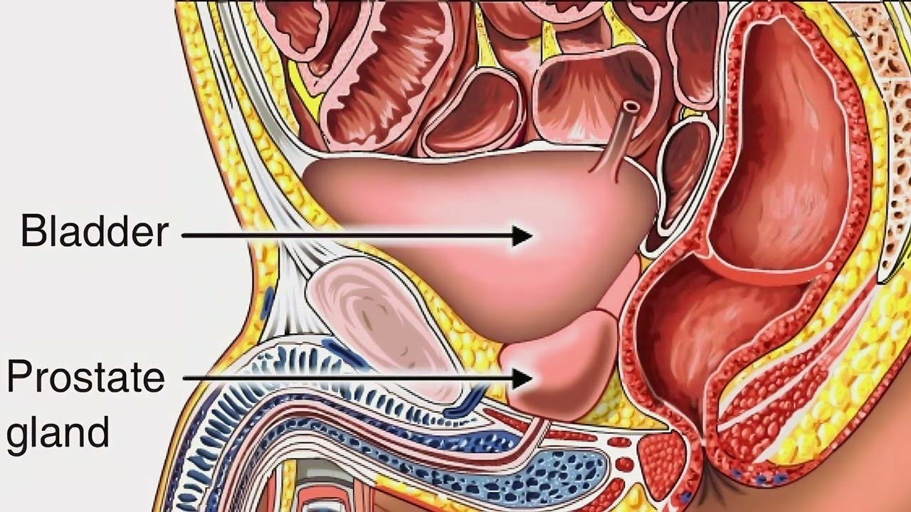 Prostate Regeneration Morphic Field - Cure Enlarged Prostate & Other Prostate Diseases