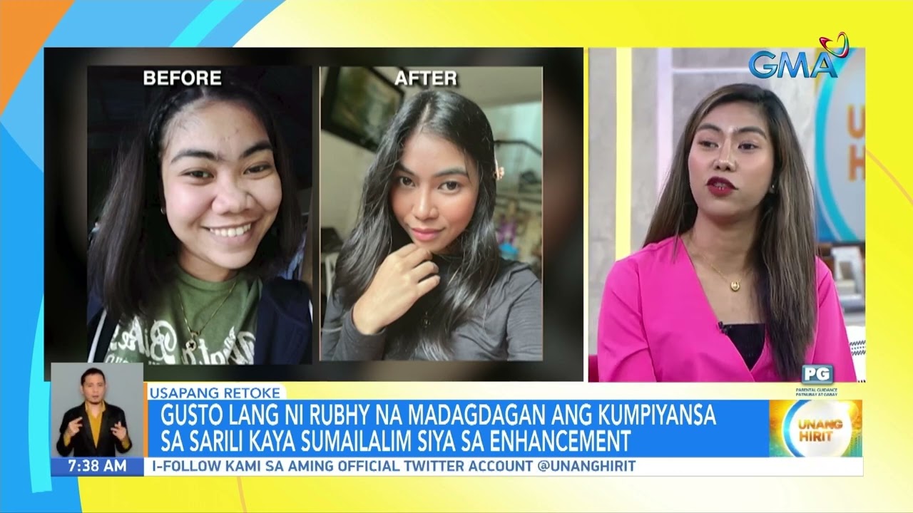 Dalagang nagpa-rhinoplasty para tumangos ang ilong, ating kilalanin! | Unang Hirit