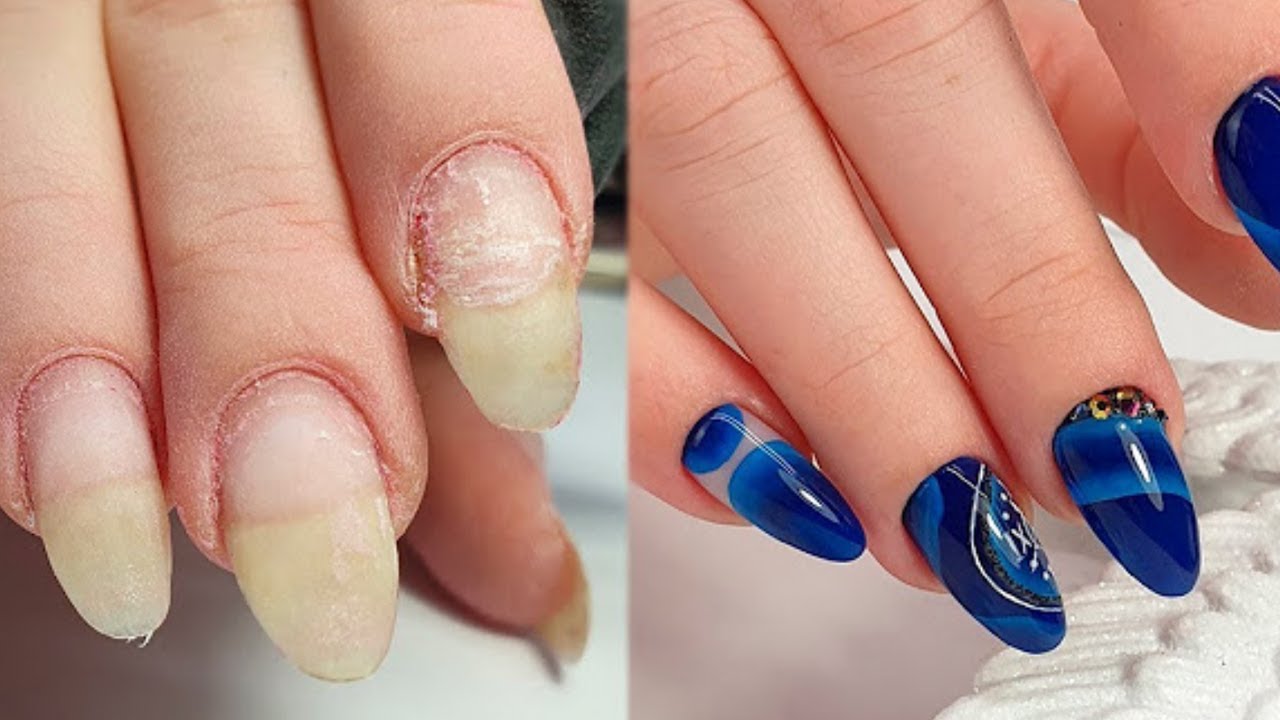 😱 Sniping Off MEATY CUTICLES  / Winter Mani With Gel