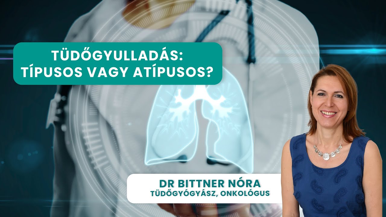Tüdőgyulladás két arca: Típusos vs. atípusos – Ismerje fel időben!