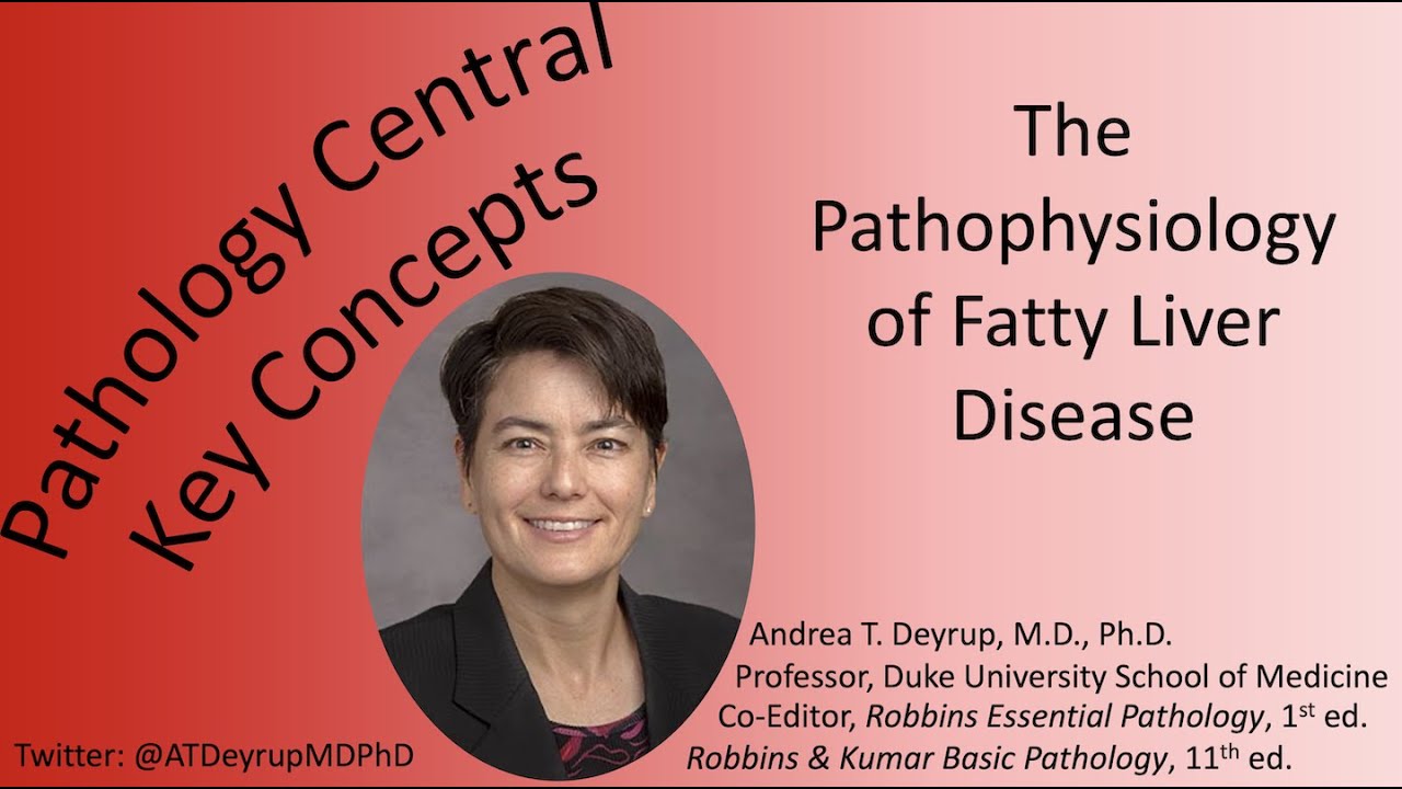 Medical School Pathology: The Pathophysiology of Fatty Liver Disease