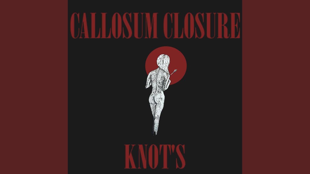 Knot's