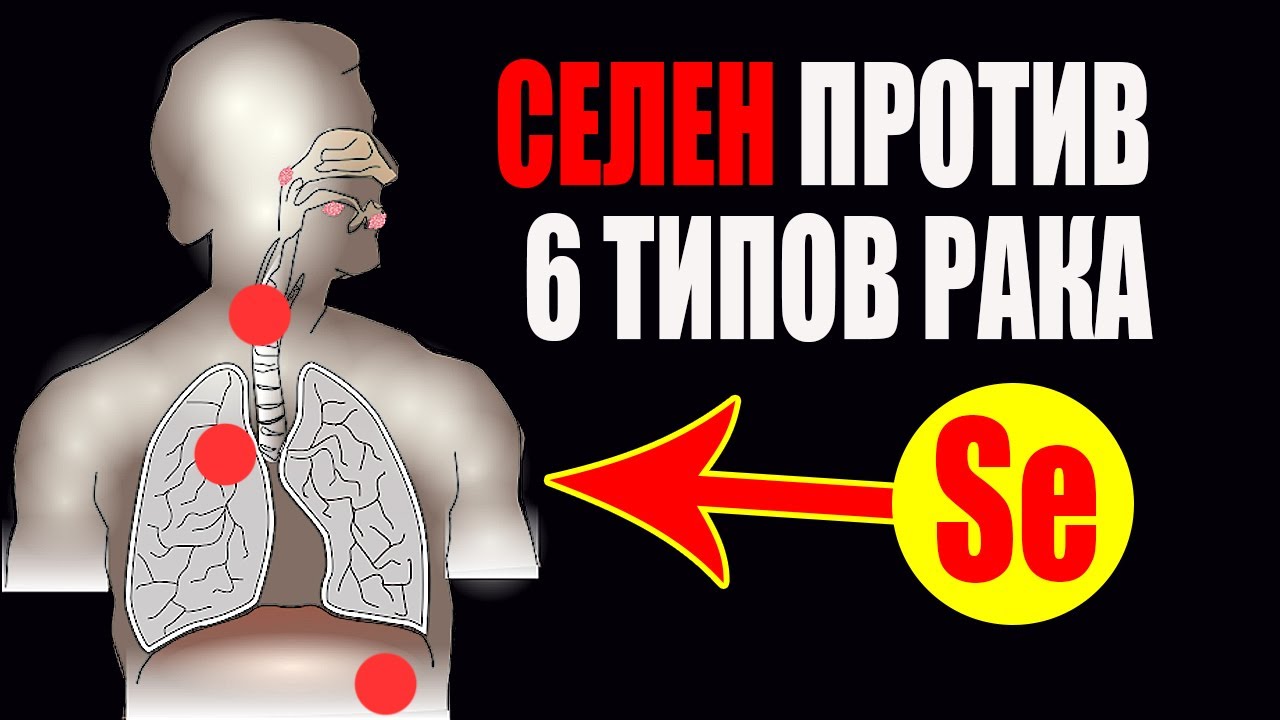 Селен и рак: что произойдет, если начать прямо сейчас?