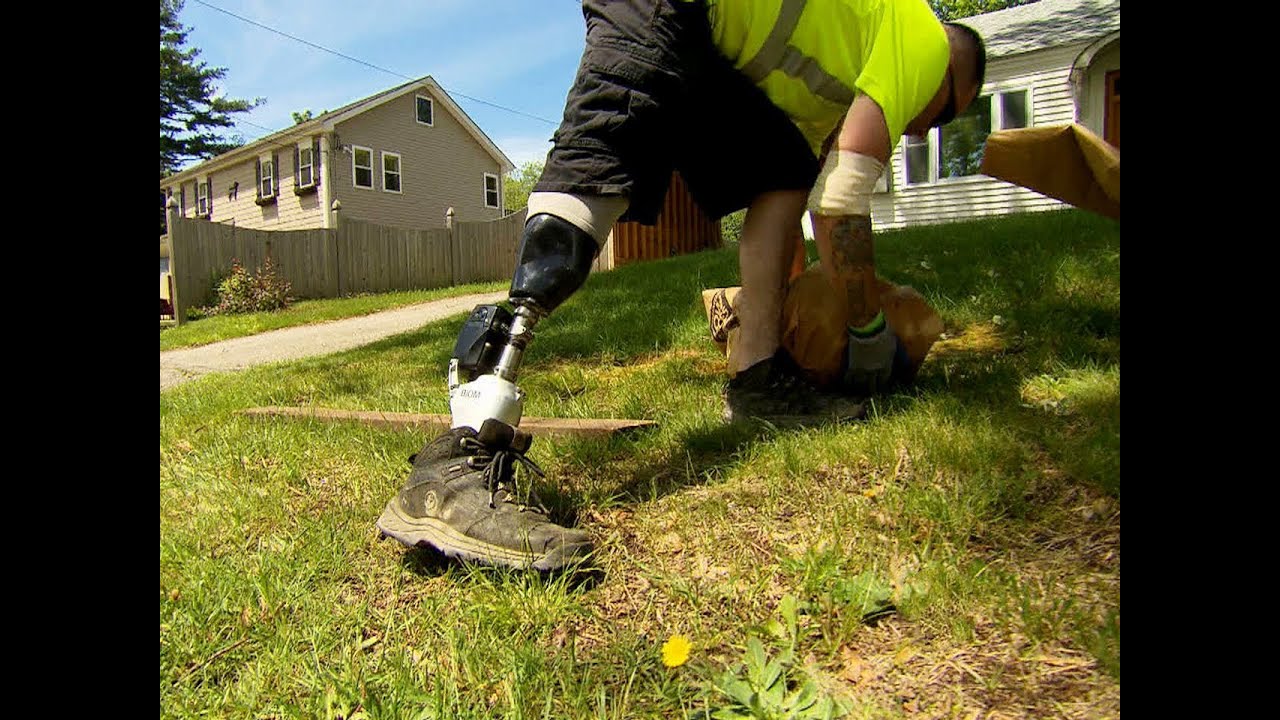 CBS Evening News with Scott Pelley - Bionic limbs giving new life to amputees