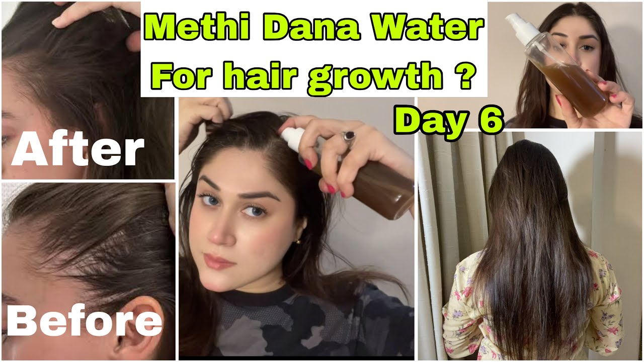 How To Regrow Lost Hair || DIY Homemade Hair Toner For Regrowth Naturally || 10x Hair Growth Toner 