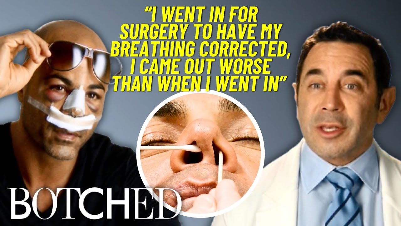 Dr. Nassif Delivers A KNOCKOUT Result For This Former Boxer&rsquo;s Botched Nose Job | Botched | E!