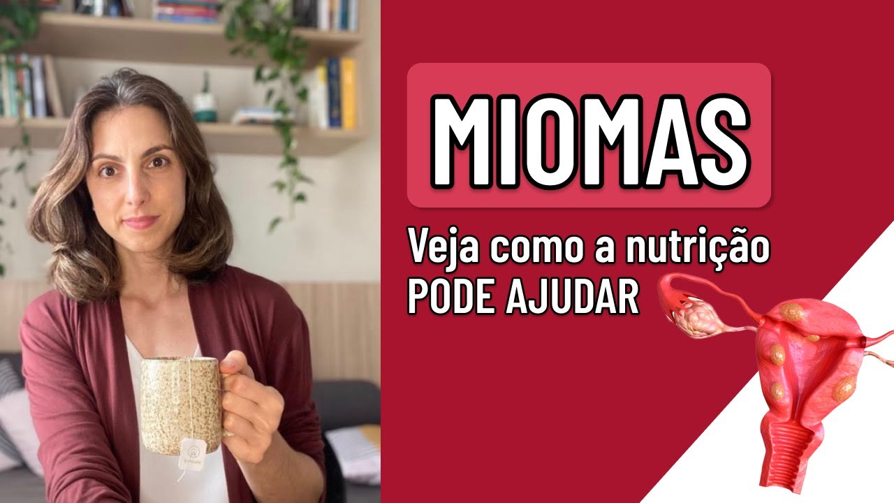 Sofrendo com Miomas? Veja Como Aliviar os Sintomas! 🌿💡