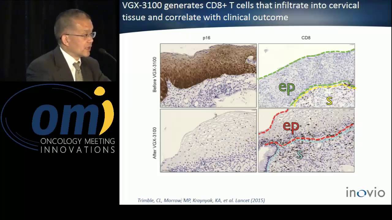 INO-5150: A PSA- and PSMA-DNA based vaccine for prostate  - Zane Yang