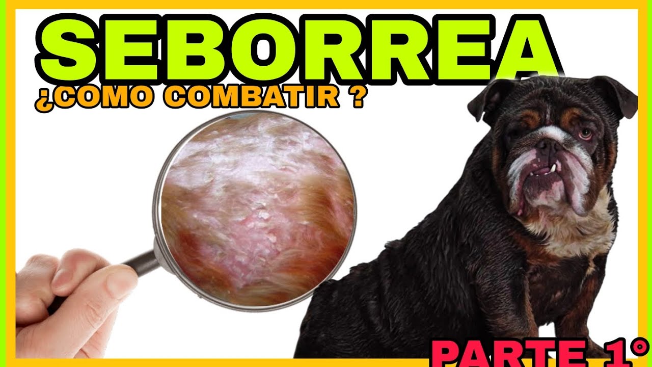 ¿COMO COMBATIR LA SEBORREA ?😰 