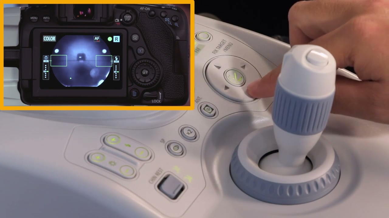 MED1400 EC Canon CR 2 Plus AF and imageSPECTRUM Capture Plus Tutorial