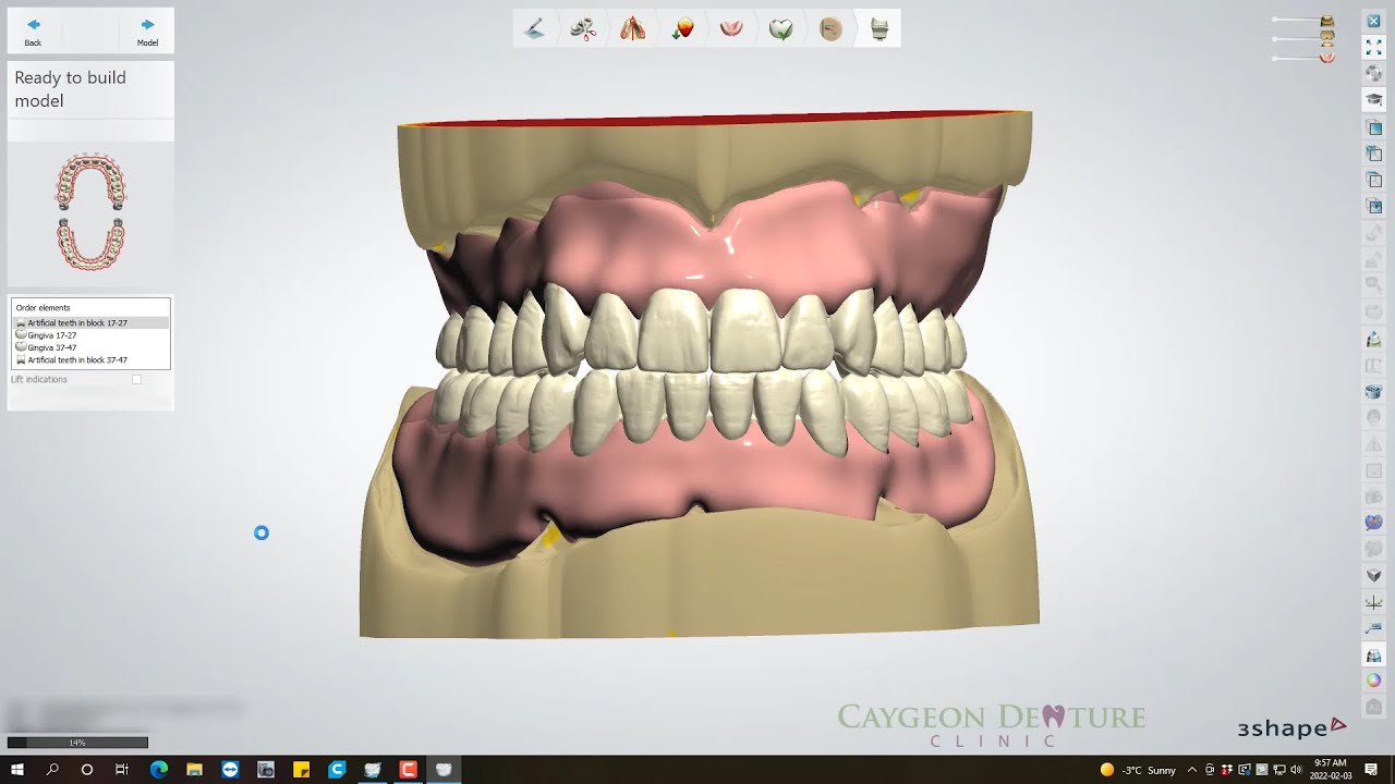 Complete Denture Design