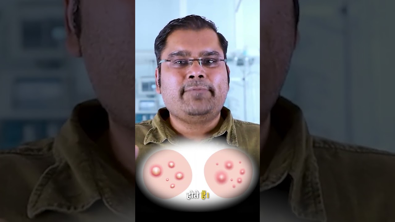 Scrotum Sebaceous Cyst EXPLAINED in 5 Minutes