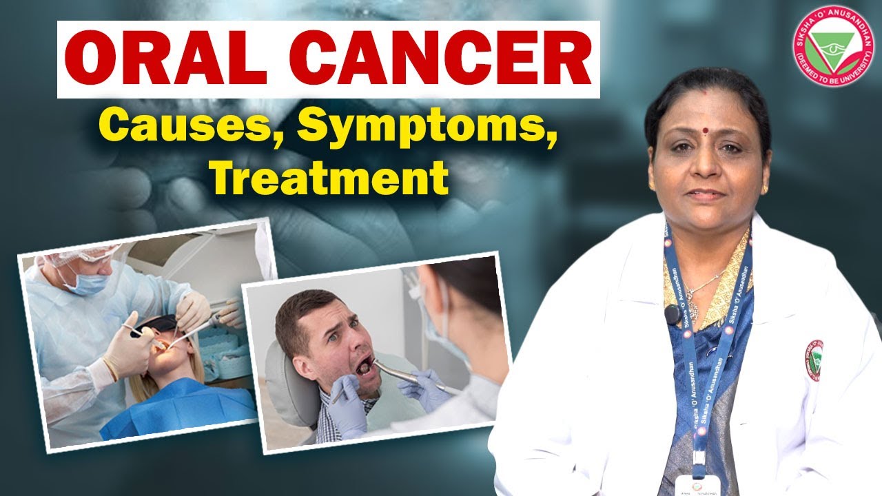 Oral Cancer: Causes, Symptoms & Treatment | IDS, SOA University
