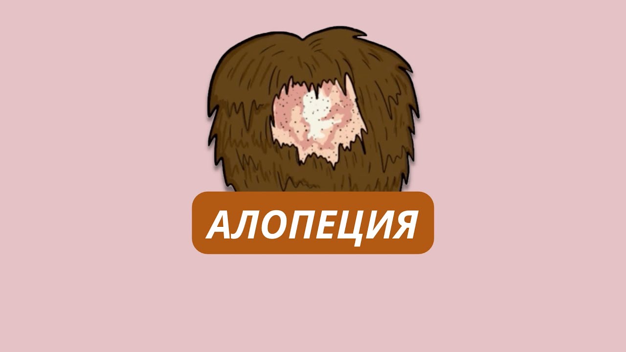 Из-за чего появляется алопеция? Типы, причины и терапия.