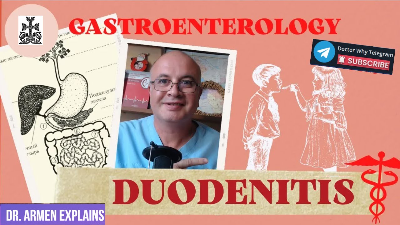 Duodenitis: Inflammation of the lining of the duodenum