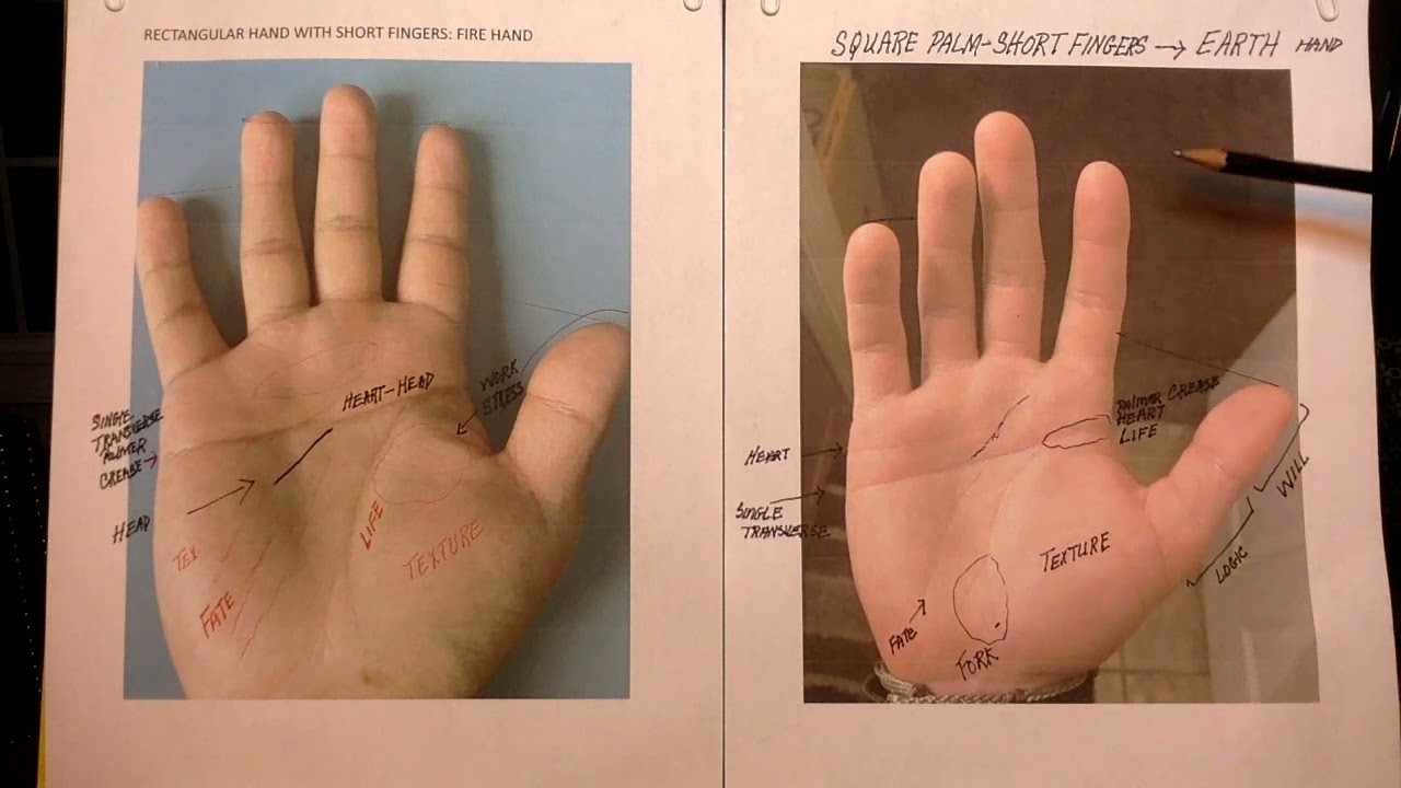 398 READING A HAND WITH A SINGLE TRANSVERSE PALMAR CREASE.