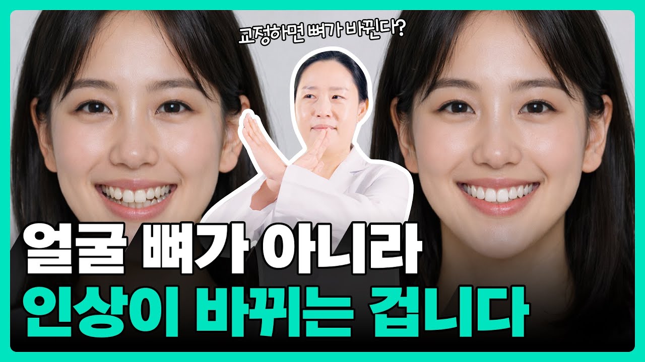 치아교정 하면 정말 얼굴형이 바뀔까? 🧐