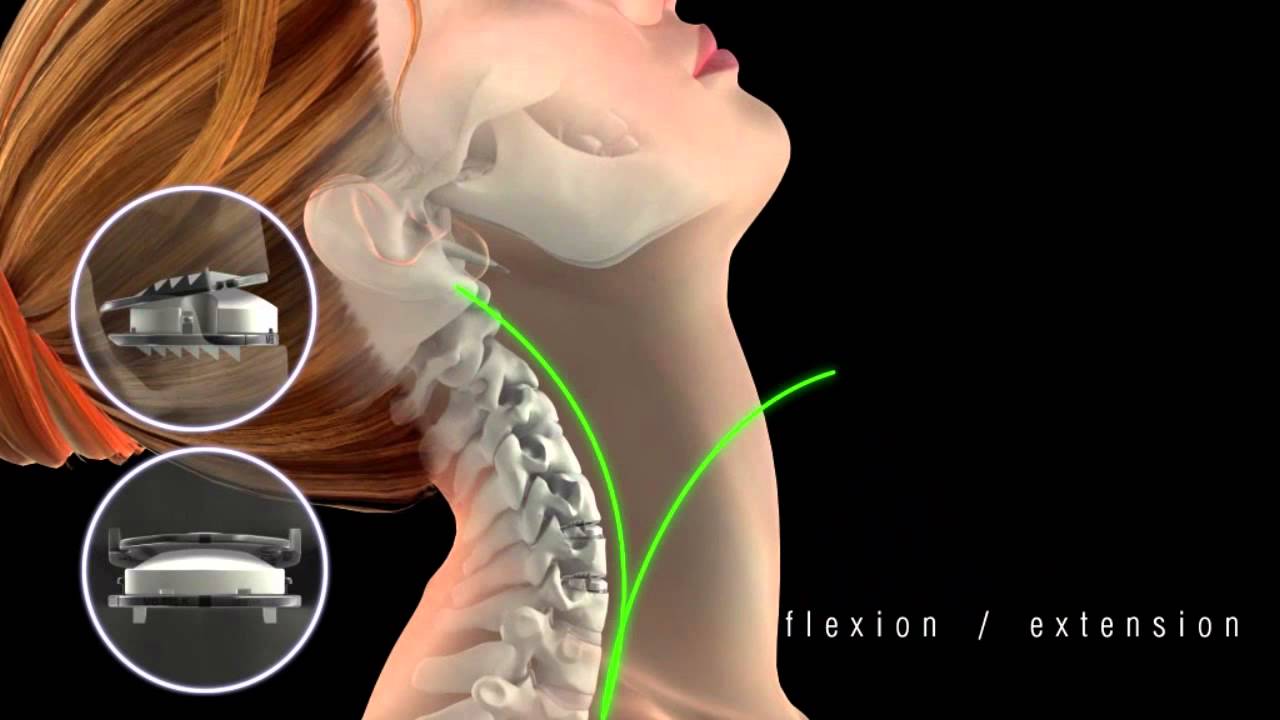 Mobi C short animation clip: movement in the neck