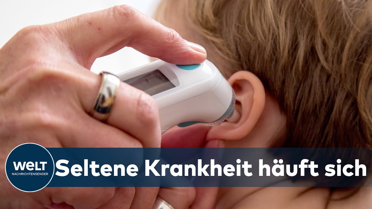 KAWASAKI SYNDROM: Seltene Kinderkrankheit mit möglichem COVID-19-Zusammenhang