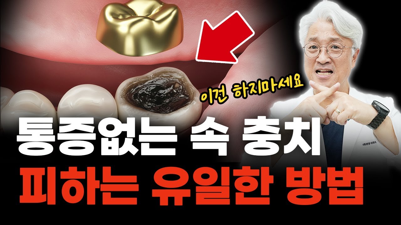 안 아픈데 치아가 부러진다고요? '충치'의 소름 돋는 실체 #인천치과 #주안동치과 #미추홀구치과