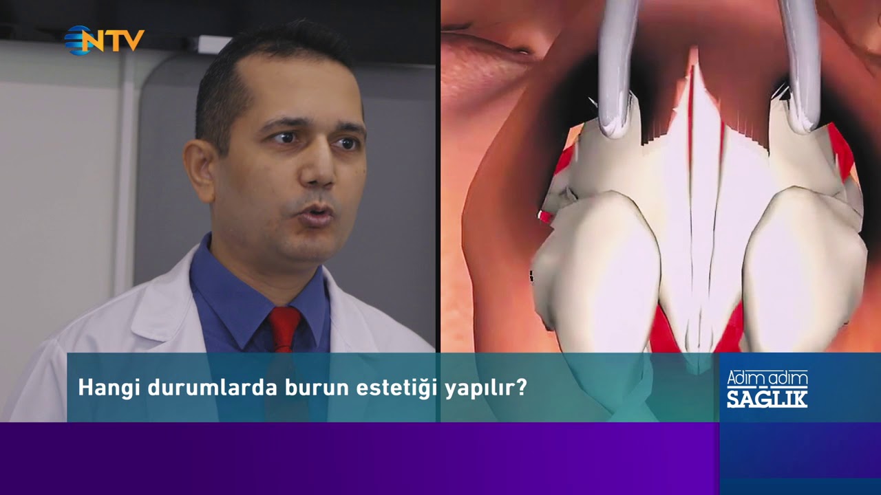 Burun Tıkanıklığının Nedenleri ve Tedavi Yöntemleri