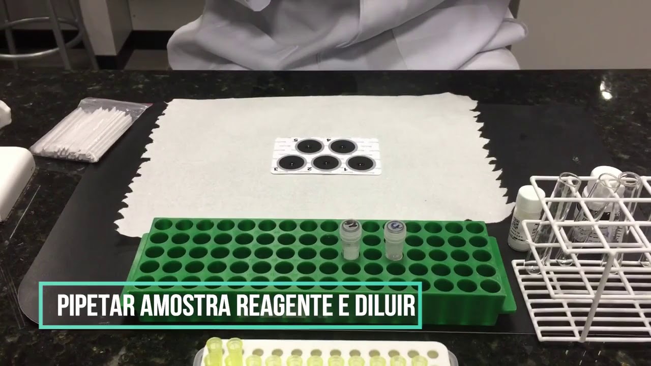 UniRitter_ACIII: PCR  PROTEINA C REATIVA