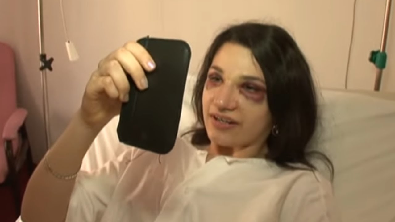 Ma fille de 15 ans va en Tunisie se faire refaire le nez