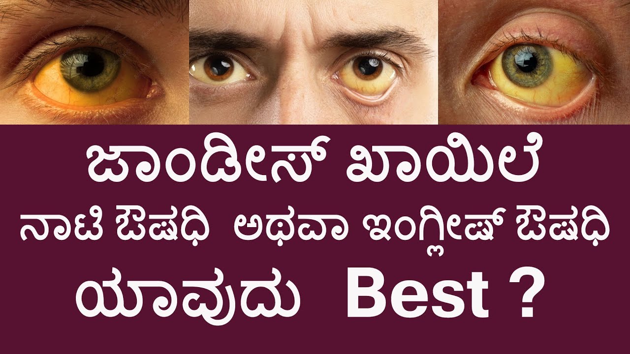 ಜಾಂಡೀಸ್ ಖಾಯಿಲೆಗೆ ನಾಟಿ ಔಷಧಿ ಅಥವಾ ಇಂಗ್ಲೀಷ್ ಔಷಧಿ ಯಾವುದು ಸರಿ? ||Jaundice-Graft Drug or English Medicine?