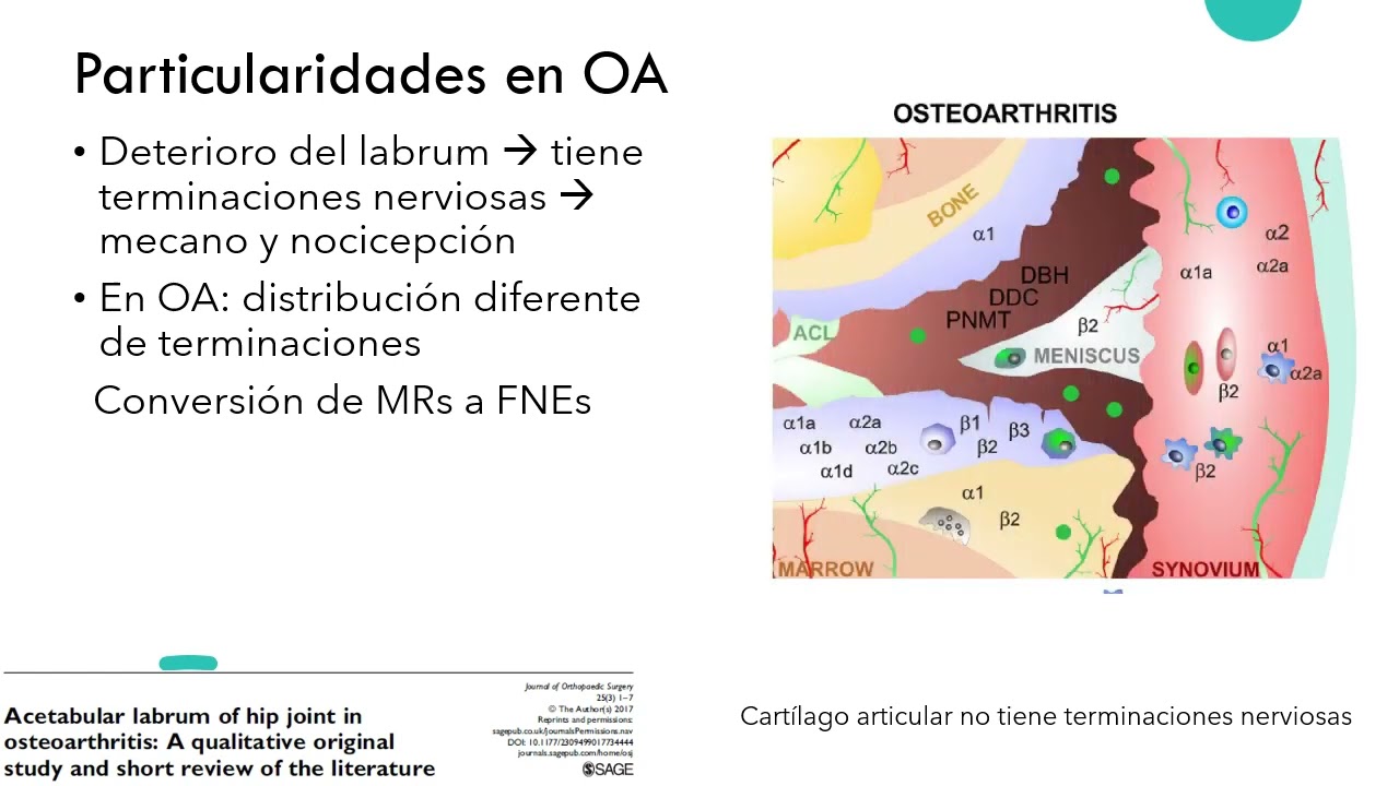 ANALGESIA MULTIMODAL EN ARTROSCOPIA DE CADERA.