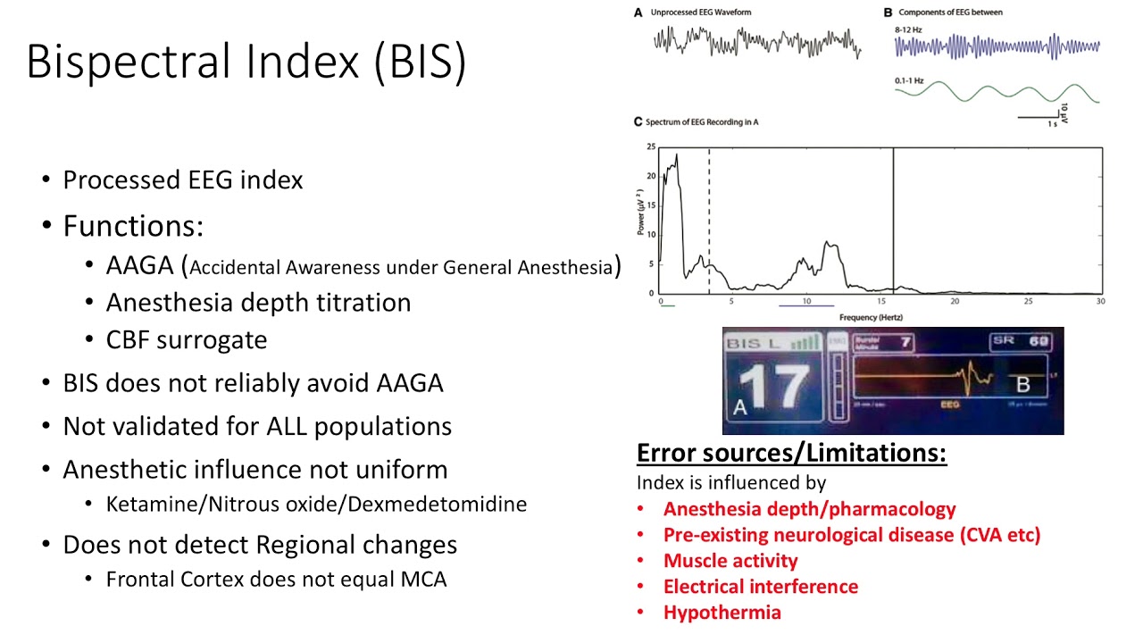 Principles of Neuromonitoring - (Dr. Rebel)