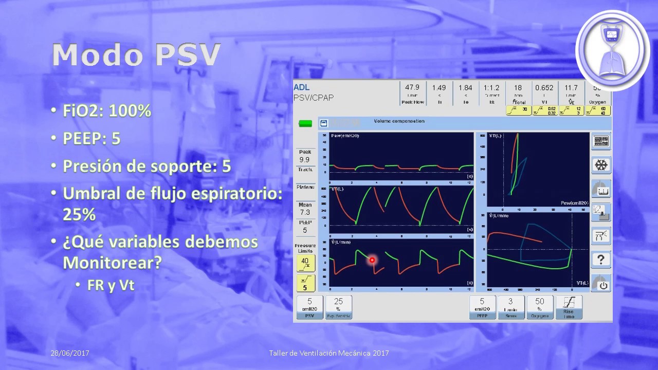 Ventilación por presión de soporte
