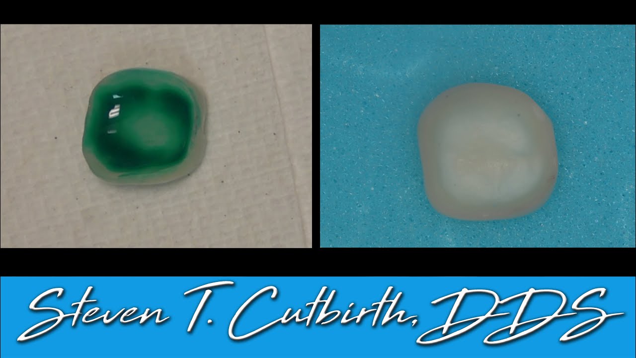 Treatment of Lithium Disilicate (Emax) Crowns & Veneers Prior to Seating - Steven T. Cutbirth, DDS