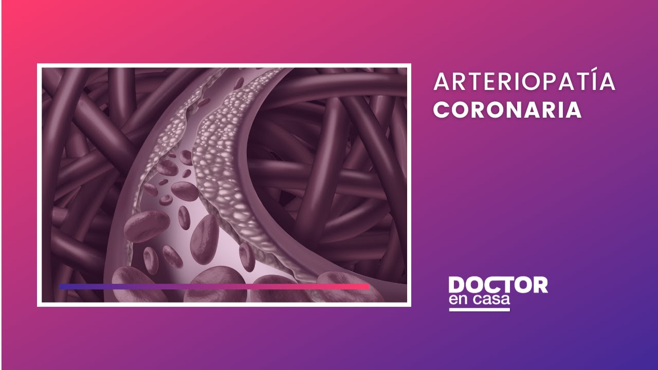 Arteriopat&iacute;a coronaria