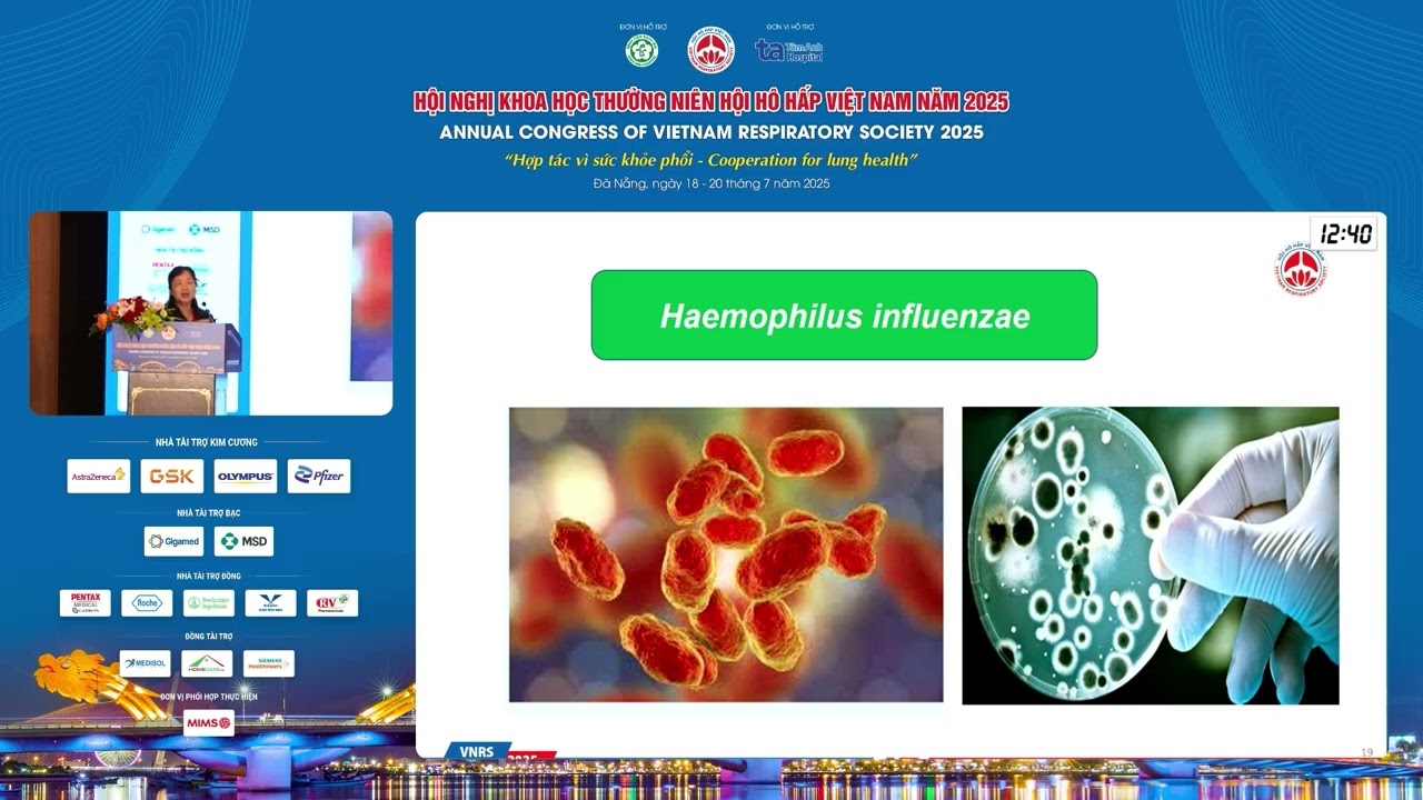 Lê Thị Hồng Hanh - Viêm phổi cộng đồng ở trẻ em: thách thức và giải pháp