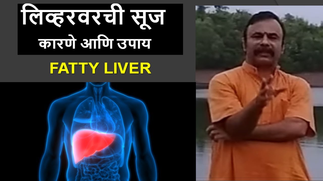 लिव्हरवरची सूज - कारणे आणि उपाय / Fatty Liver / दामले उवाच भाग १५८